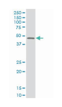MEF2B, Mouse, Clone: 4B5, Abnova 200&mu;L; Unlabeled:Antibodies, Monoclonal