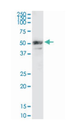 matrix metallopeptidase 3 (stromelysin 1, progelatinase), Rabbit, Purified