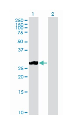 matrix metallopeptidase 7 (matrilysin, uterine), Rabbit, Purified MaxPab Polyclonal Antibody, Abnova 100 &mu;g | Buy Online | Abnova | Fisher Scientific