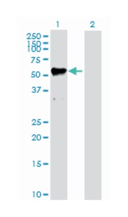 matrix metallopeptidase 12 (macrophage elastase), Rabbit, Purified MaxPab