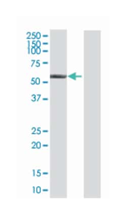 aldehyde dehydrogenase 6 family, member A1, Mouse, Polyclonal Antibody,