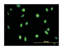 N-methylpurine-DNA glycosylase, Mouse, Clone: 2C5, Abnova 100&mu;g; Unlabeled:Antibodies,