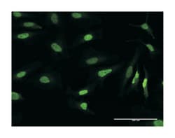 mutS homolog 2, colon cancer, nonpolyposis type 1 (E. coli), Rabbit, Purified