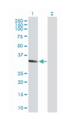 msh homeobox 1, Rabbit, Purified MaxPab Polyclonal Antibody, Abnova 100&mu;g;