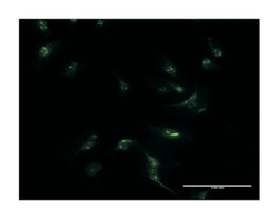 MSX1, Mouse, Clone: 1E2, Abnova&trade;