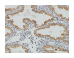 muscle, skeletal, receptor tyrosine kinase, Mouse, Clone: 2H6, Abnova 100&mu;g;