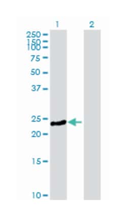 myosin, light chain 3, alkali; ventricular, skeletal, slow, Mouse, Purified