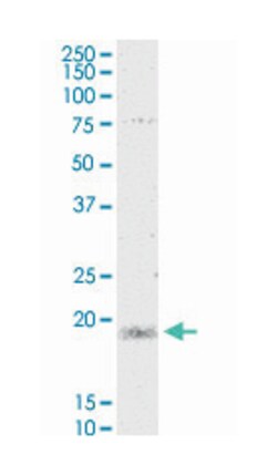 myosin, light chain 5, regulatory, Mouse, Clone: 3D12, Abnova 100 &mu;g | Buy Online | Abnova Corporation | Fisher Scientific