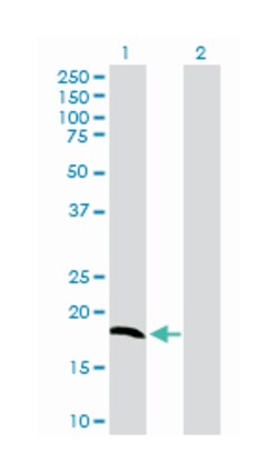 NDUFA8, Mouse, Purified MaxPab Polyclonal Antibody, Abnova 50 &mu;g | Buy Online | Abnova | Fisher Scientific