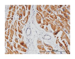 NDUFA8, Mouse, Clone: 2E10, Abnova 100 &mu;g | Buy Online | Abnova Corporation | Fisher Scientific