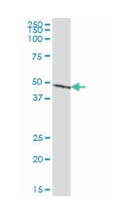 NADH dehydrogenase (ubiquinone) Fe-S protein 2, 49kDa (NADH-coenzyme Q