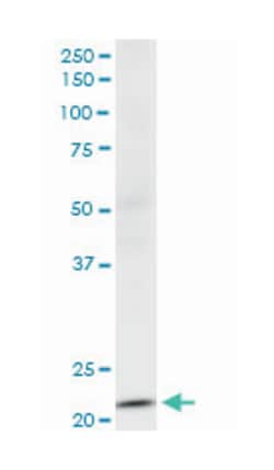NDUFV2, Mouse, Clone: 1A10, Abnova 100&mu;g; Unlabeled:Antibodies, Monoclonal