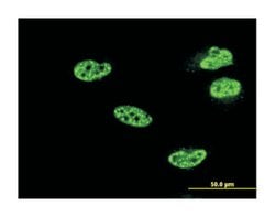 NFKB1, Mouse, Clone: 4A11, Abnova 100&mu;g; Unlabeled:Antibodies, Monoclonal
