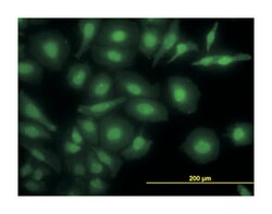 NR4A2, Mouse, Clone: 2G5, Abnova 100 &mu;g | Buy Online | Abnova Corporation | Fisher Scientific