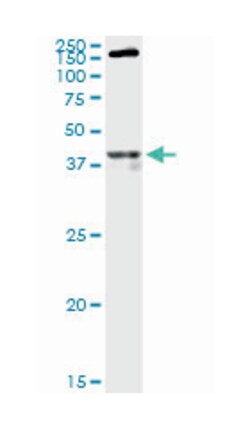 opioid receptor, mu 1, Mouse, Polyclonal Antibody, Abnova 50&mu;L; Unlabeled:Antibodies,