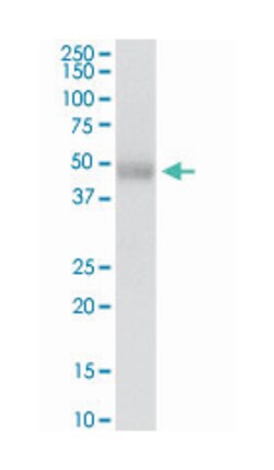 purinergic receptor P2X, ligand-gated ion channel, 5, Rabbit, Purified