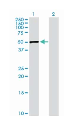 serpin peptidase inhibitor, clade E (nexin, plasminogen activator inhibitor