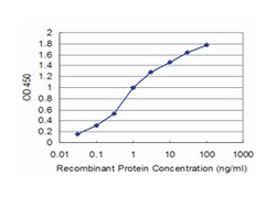 pyruvate dehydrogenase kinase, isozyme 4, Mouse, Clone: 1A10, Abnova™