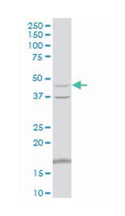 phosphoglycerate kinase 2, Mouse, Polyclonal Antibody, Abnova 50&mu;L;