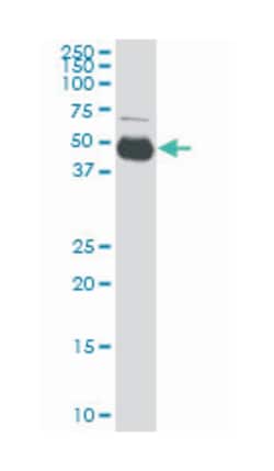 SERPINI1, Mouse, Clone: 1E10, Abnova 100&mu;g; Unlabeled:Anticuerpos