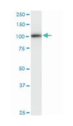 phospholipase D2, Mouse, Clone: 1C5, Abnova&trade;