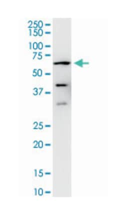 protein phosphatase 3 (formerly 2B), catalytic subunit, alpha isoform,