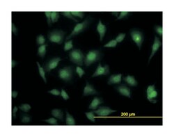 MAPK3, Mouse, Clone: 1E2, Abnova 100 &mu;g | Buy Online | Abnova Corporation | Fisher Scientific