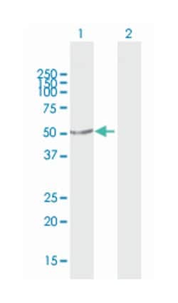 protein kinase, X-linked, Mouse, Purified MaxPab Polyclonal Antibody, Abnova