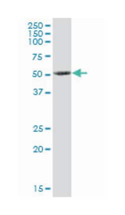 protein kinase, X-linked, Mouse, Purified MaxPab Polyclonal Antibody, Abnova