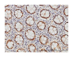 proteasome (prosome, macropain) subunit, beta type, 6, Mouse, Clone: S51,