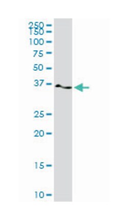 twinfilin, actin-binding protein, homolog 1 (Drosophila), Mouse, Clone: