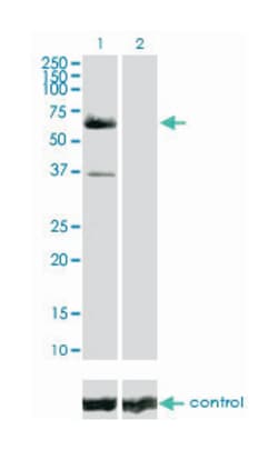 v-raf-1 murine leukemia viral oncogene homolog 1, Mouse, Clone: 1H4, Abnova 100 &mu;g | Buy Online | Abnova | Fisher Scientific