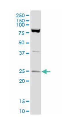 RAN, member RAS oncogene family, Mouse, Polyclonal Antibody, Abnova 50&mu;L;