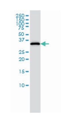 retinaldehyde binding protein 1, Mouse, Clone: 4H5, Abnova 100&mu;g; Unlabeled:Antibodies,