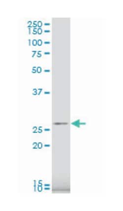 ribosomal protein S9, Mouse, Polyclonal Antibody, Abnova 50&mu;L; Unlabeled:Antibodies,