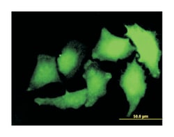 S100 calcium binding protein A2, Mouse, Clone: M2, Abnova™