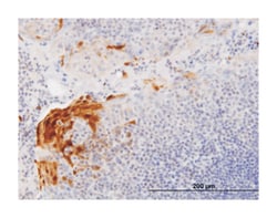 S100 calcium binding protein A7 (B01), Mouse anti-Human, Polyclonal Antibody, Abnova&trade;