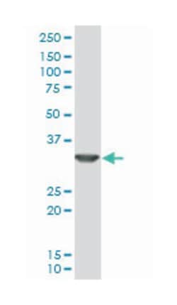 sex hormone-binding globulin, Mouse, Polyclonal Antibody, Abnova 50&mu;L;