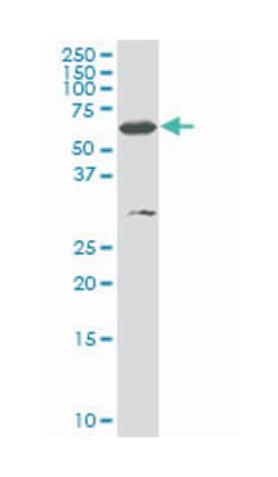 SMARCD3, Mouse, Clone: 5G4, Abnova 200&mu;L; Unlabeled:Antibodies, Monoclonal