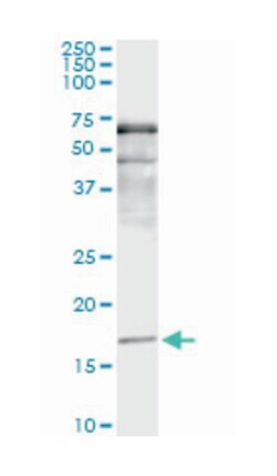 SNCA, Mouse, Clone: 2E4, Abnova 100 &mu;g | Buy Online | Abnova Corporation | Fisher Scientific