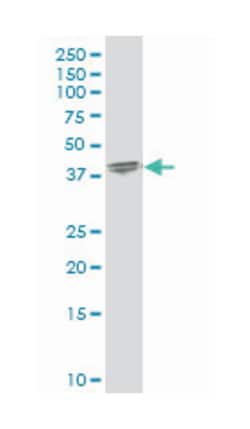 SRY (sex determining region Y)-box 12, Mouse, Polyclonal Antibody, Abnova