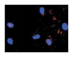 signal transducer and activator of transcription 5A, Rabbit, Purified MaxPab™ Polyclonal Antibody, Abnova™