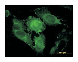 syntaxin 1A (brain), Mouse, Clone: 1B11-1A8, Abnova 100 &mu;g | Buy Online | Abnova Corporation | Fisher Scientific