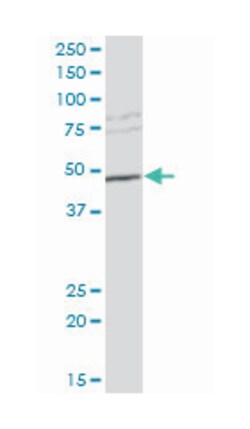 sulfotransferase family, cytosolic, 2B, member 1, Mouse, Polyclonal Antibody, Abnova 50 &mu;L | Buy Online | Abnova Corporation | Fisher Scientific