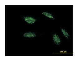 twist homolog 1 (Drosophila), Mouse, Clone: 2F8, Abnova 100&mu;g; Unlabeled:Antibodies,