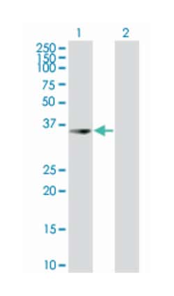 uroporphyrinogen decarboxylase (B02), Mouse anti-Human, Polyclonal Antibody, Abnova&trade;