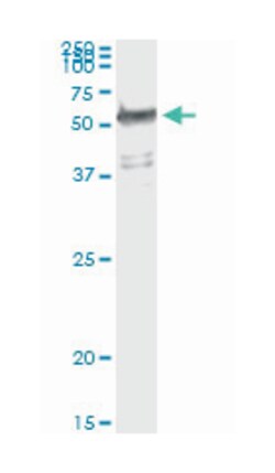 tryptophanyl-tRNA synthetase, Mouse, Clone: 3A12, Abnova 100&mu;g; Unlabeled:Antibodies,