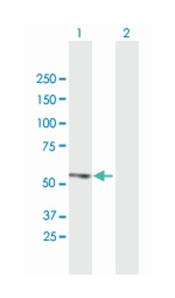 zinc finger protein 161 homolog (mouse), Mouse, Purified MaxPab Polyclonal Antibody, Abnova 50 &mu;g | Buy Online | Abnova Corporation | Fisher Scientific