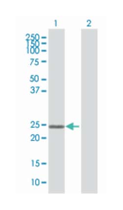 zinc finger protein 22 (KOX 15), Mouse, Polyclonal Antibody, Abnova 50&mu;L;