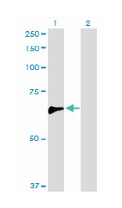 Rho guanine nucleotide exchange factor (GEF) 5, Rabbit, Purified MaxPab Polyclonal Antibody, Abnova 100 &mu;g | Buy Online | Abnova | Fisher Scientific